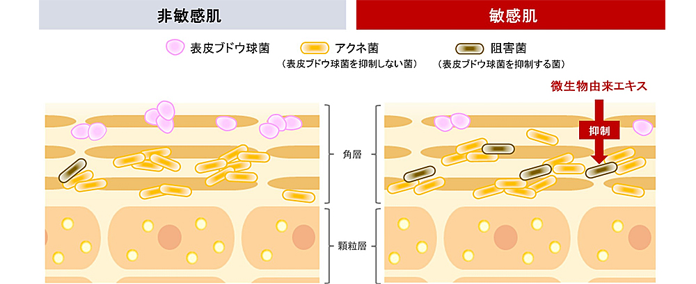 敏感肌に潜む“阻害菌”を発見