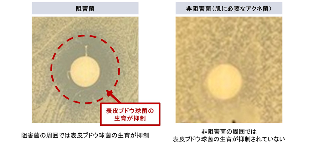 敏感肌に潜む“阻害菌”を発見