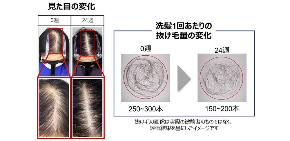 洗髪1回あたりの抜け毛本数が減少