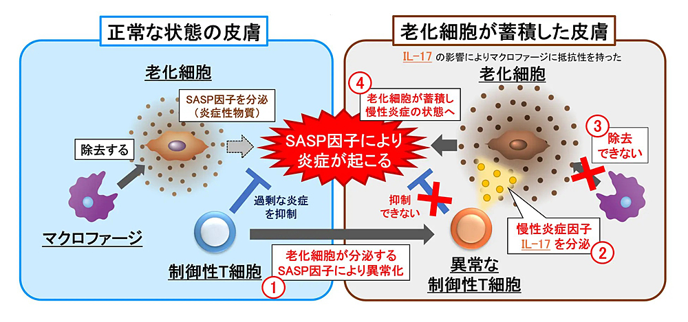 老化細胞から分泌されるSASP因子が制御性T細胞を異常化させ、IL-17の分泌を通じてマクロファージの老化細胞除去機能を抑制し、皮膚に慢性炎症と老化を引き起こす仕組みを示した模式図